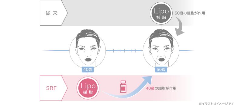 従来とSRFの対比イメージ2